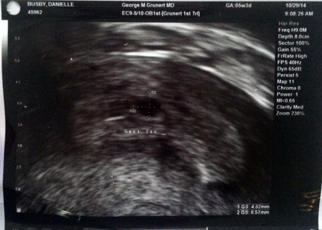 First Ultrasound